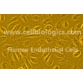 Human Primary Carotid Artery Endothelial Cells